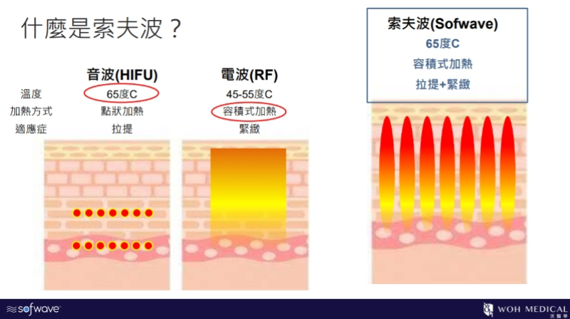 索夫波有音波的高溫及電波的容積式加熱方式,可以一次達到拉提+緊緻的功效