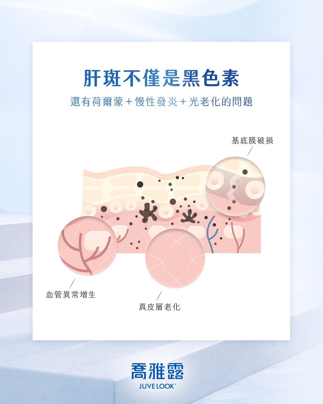 有肝斑困擾?喬雅露有機會幫上忙